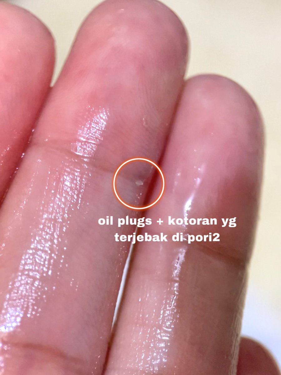 azeclair's tweet photo. Cleansing Balm Sea Makeup formula baru ya?? Lebih deep cleansing cuyy tiap sore bersihin muka pake ini selalu keluar oil plugs 😳 bahaya nih kalau dibiarin bisa jadi komedo👊

Ada yg pake juga ga? Seneng deh harganya murah dan aman walau kulit lg breakout🥰😌

#racuninskincare https://t.co/1VnEnfV9fB