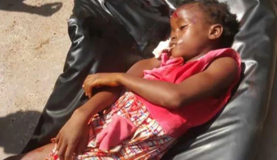 krifona's tweet photo. @antonioguterres @antonioguterres @UNICEF @JoeBiden @MichelleObama thousands of children have been killed in the #AmbazoniaGenocide AKA former British Southern Cameroons.  8 million people targeted. Hundreds of children miss school @NRC_Egeland. @Parody_PM @EmmanuelMacron end war in Ambazonia. https://t.co/nQvyVdbY8e