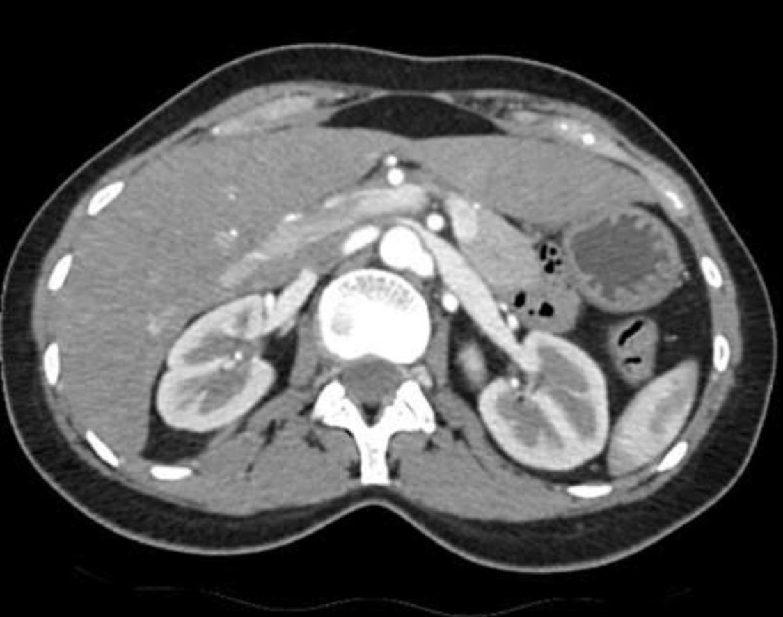 Olusegun Oyeniyi MD tweet media