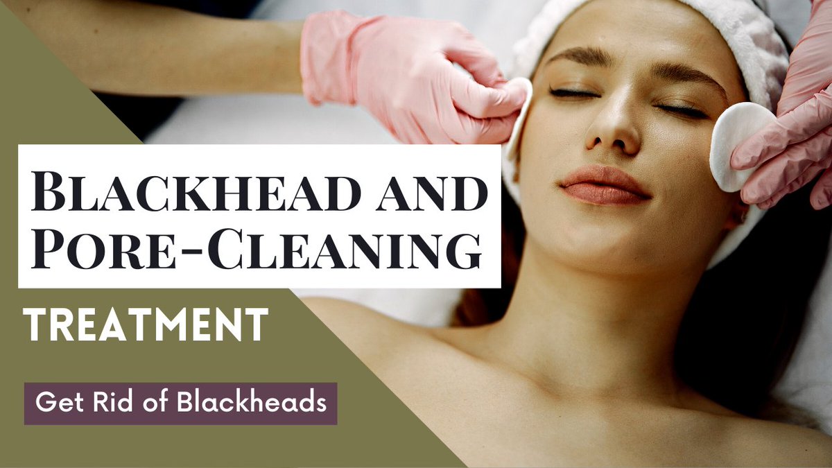 1. Blackheads are a common form of acne caused by clogged pores with a mixture of dead skin cells and excess oil. #Blackheads #Acne #SkinCare #Treatment #OverTheCounterProducts #SalicylicAcid #Exfoliation #Retinoids #ClayMasks #ChemicalPeels #FacialCleansing #MakeupRemoval