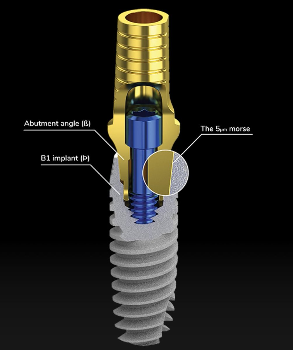 Implant (@ImplantUa) / Posts / X