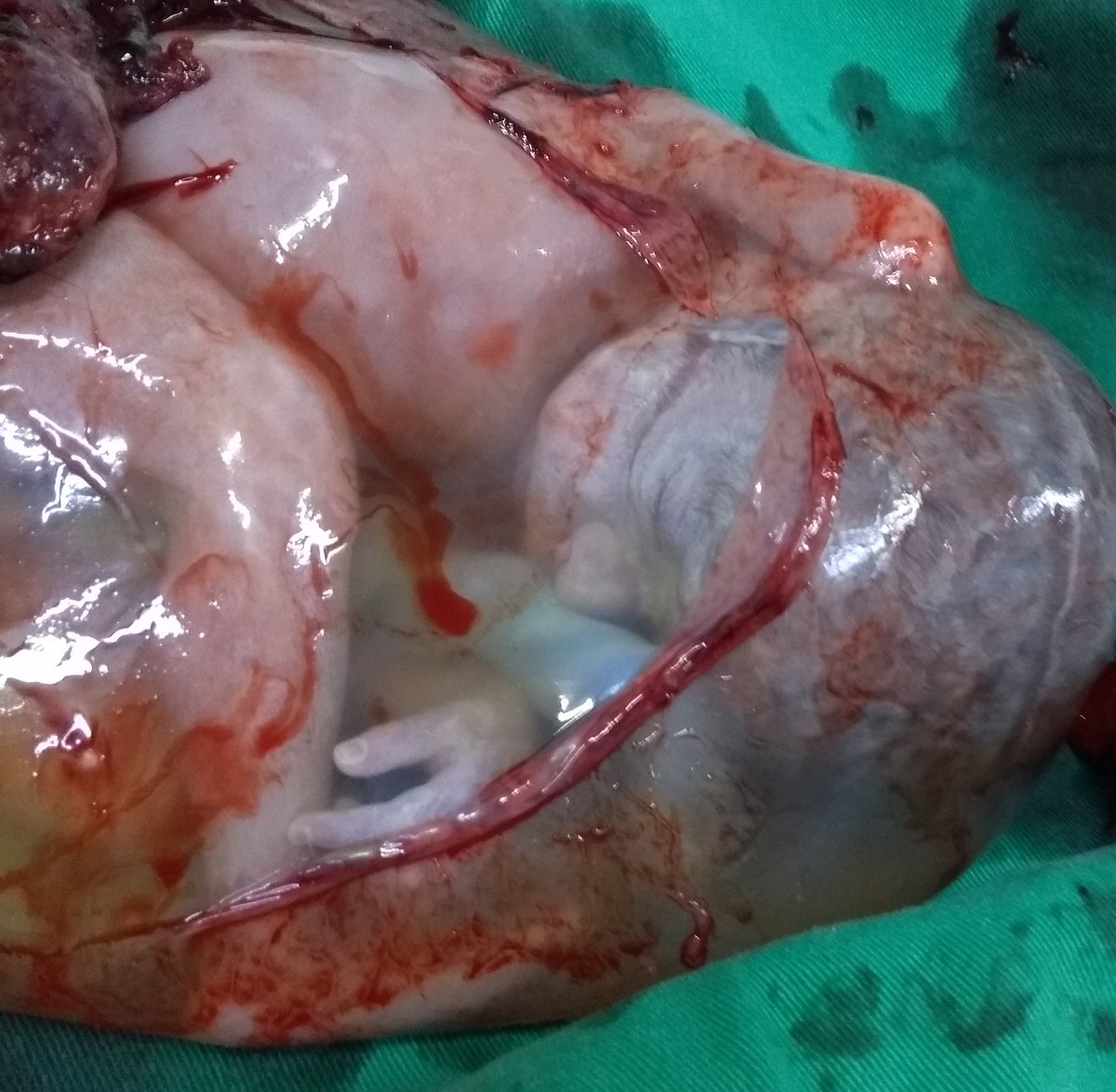 ClaudirVBrito's tweet photo. Nossa #sociedade anda tão #doente que estão preferindo condenar a #MORTE o mais inocente e menos #culpado, que #punir os verdadeiros culpados, seja o #pai ou a #mãe #INCONSEQUENTE.
@Terra__Brasilis
@brasilparalelo
@jairbolsonaro
@Biakicis
@carlosjordy https://t.co/KBlhDXenZy