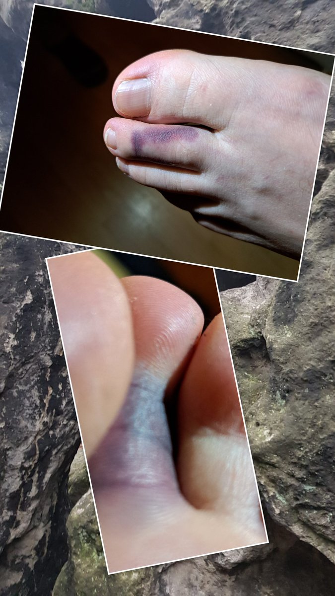 01219doppelD's tweet photo. Wer hat gesagt "Wandern ist gesund"? https://t.co/3ZFwszbS0h