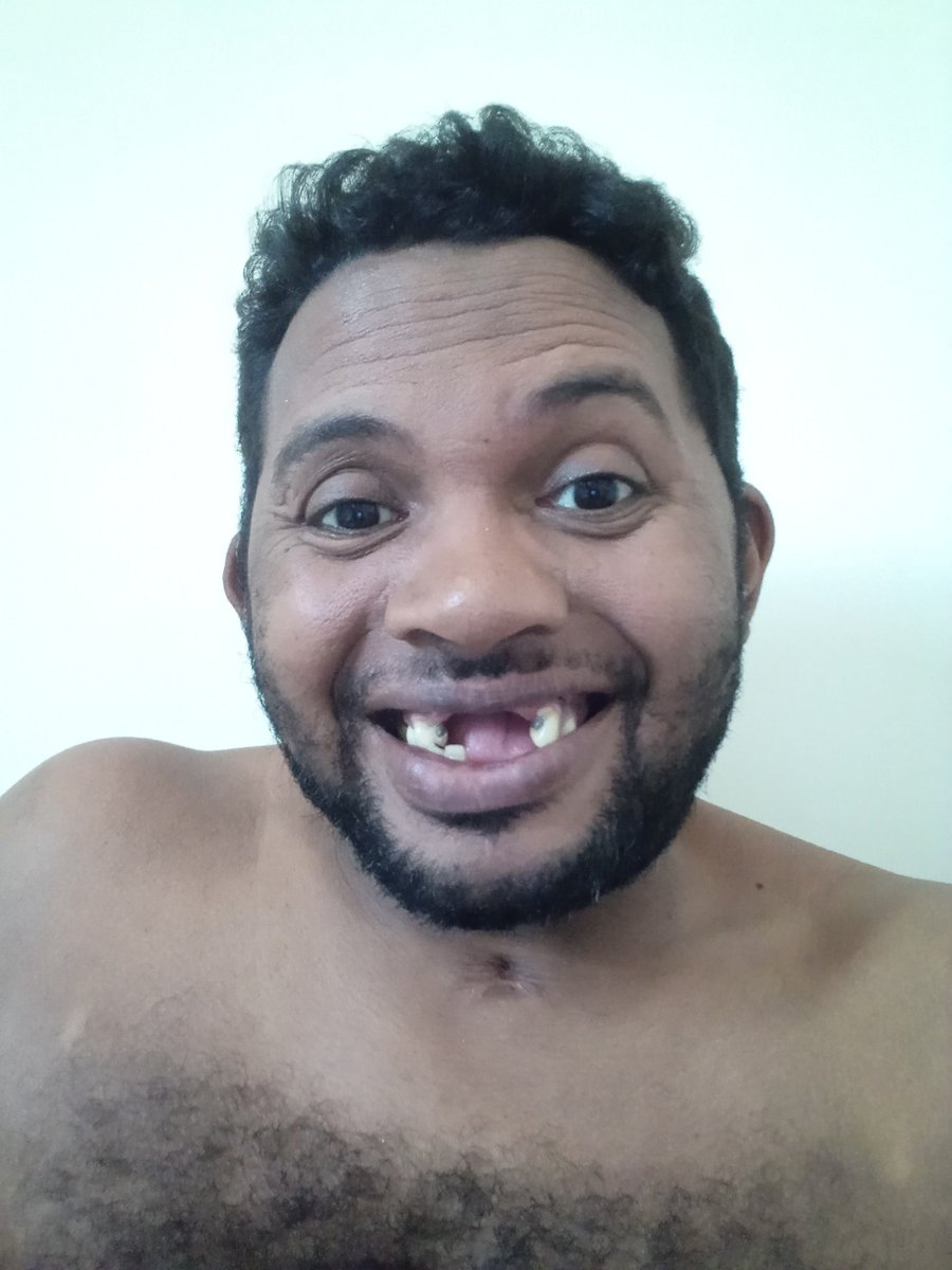 أحتاج إلى زراعة أسنان 😂😂😂