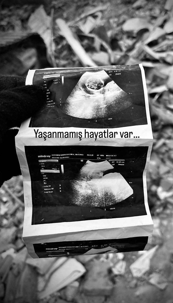 Yaşanmamış hayatlar var…