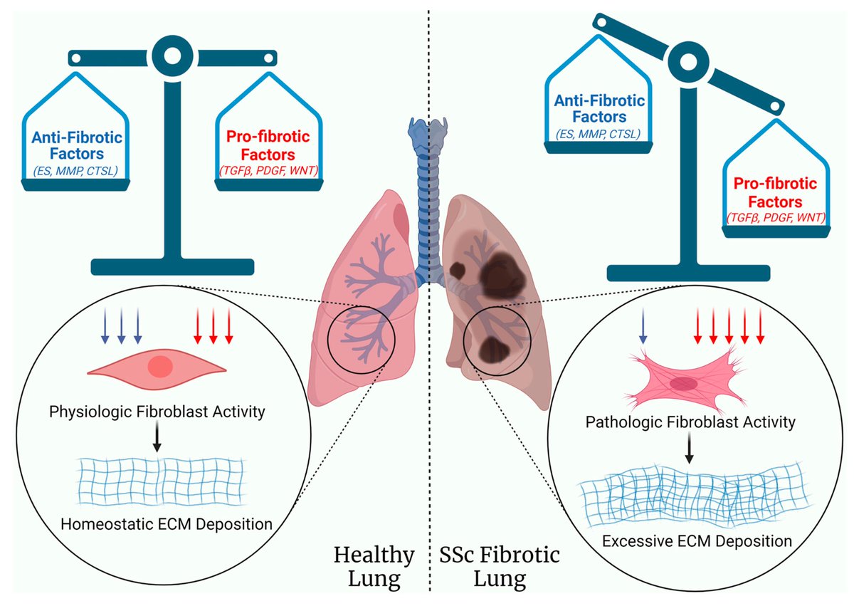 The Molecular Mechanisms of Systemic Sclerosis-Associated Lung Fibrosis

#RheumTwitter #Rheum #Rheumatology #SystemicSclerosis #Scleroderma #InterstitialLungDisease #LungFibrosis 

 doi.org/10.3390/ijms24…