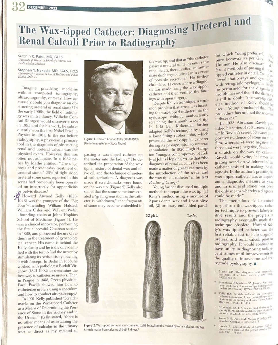 Reading all of my back #auanews today & learning more about Dr. Howard Atwood Kelly, who identified my favorite medical sign (in addition to performing the 1st successful c section, having a pretty great clamp, and advancing endourology). @AmerUrological #MedTwitter #UroSoMe