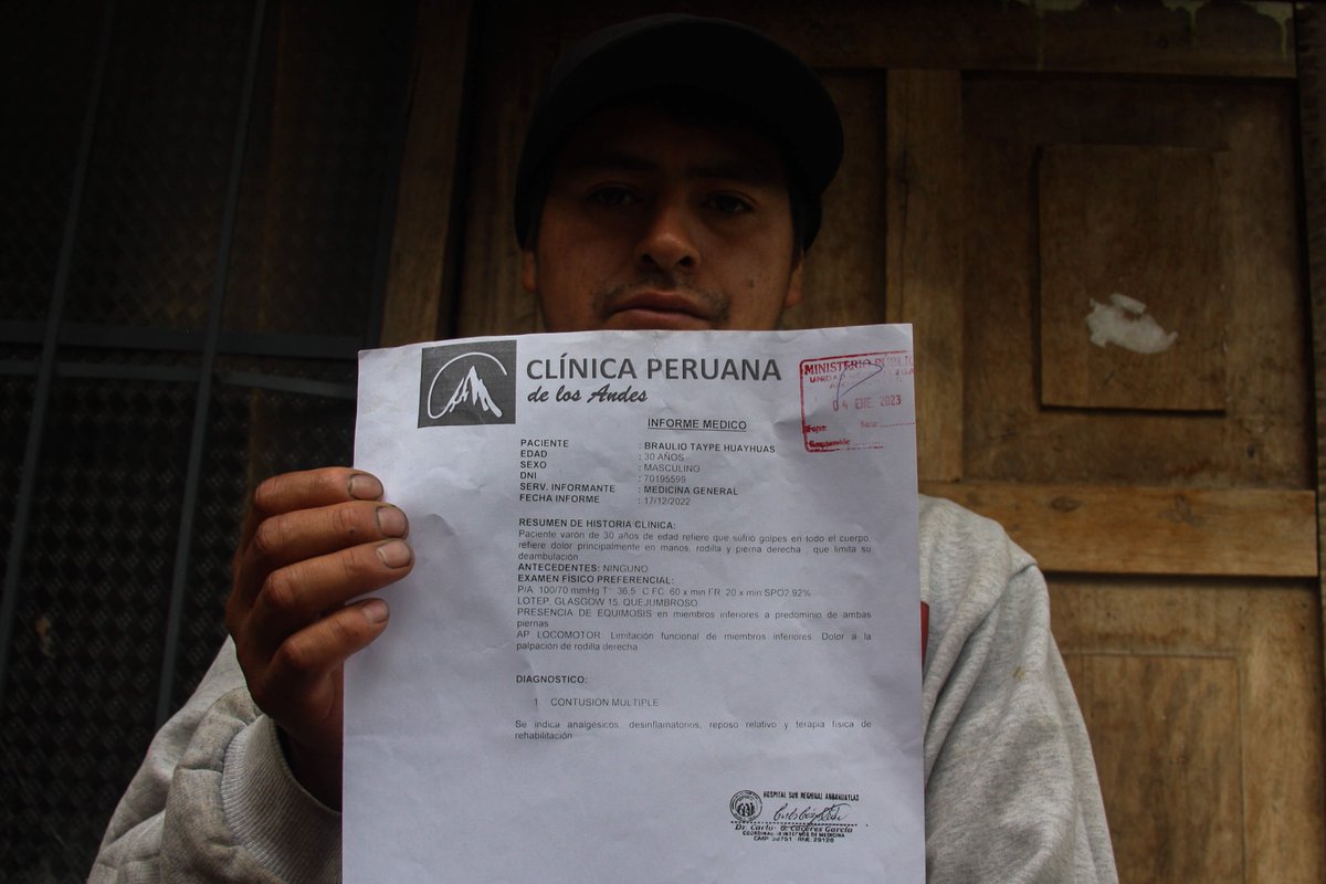 Ojo_Publico's tweet photo. Braulio Taype, de 30 años, denunció haber sido golpeado por la policía mientras estuvo recluido en la comisaría de #Andahuaylas, entre el 12 y 14 de diciembre.

📌 "Nos pateaban o nos daban con la vara en el cuerpo" dijo Braulio.

Continúa leyendo:
👉 https://t.co/6m5VzRGGzn https://t.co/Eyi7Pdbc46