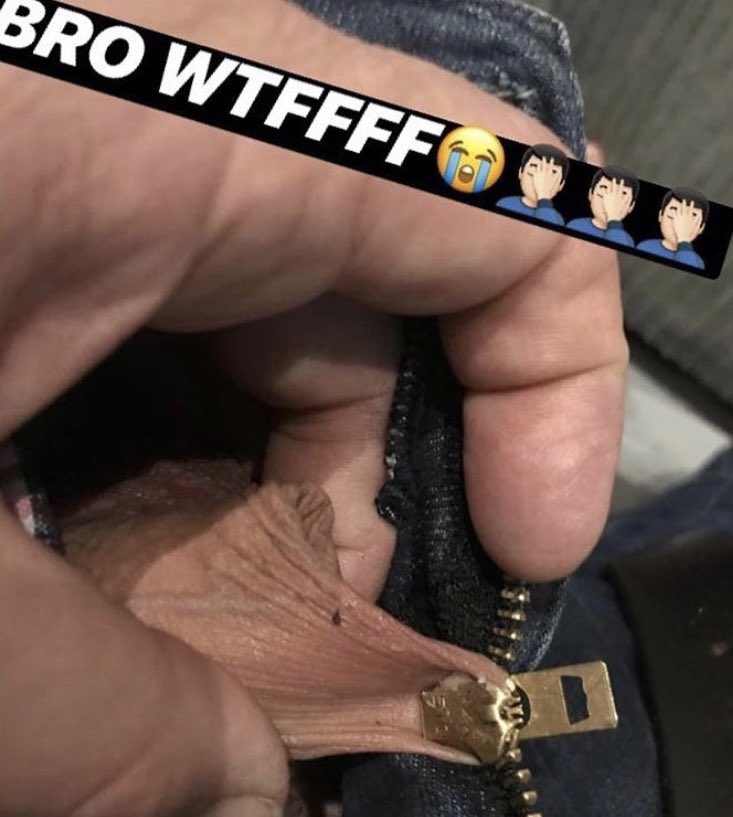 ZekeyFreaky_okm's tweet photo. So this happened … 🤕🥴 https://t.co/zAREOeEHUt
