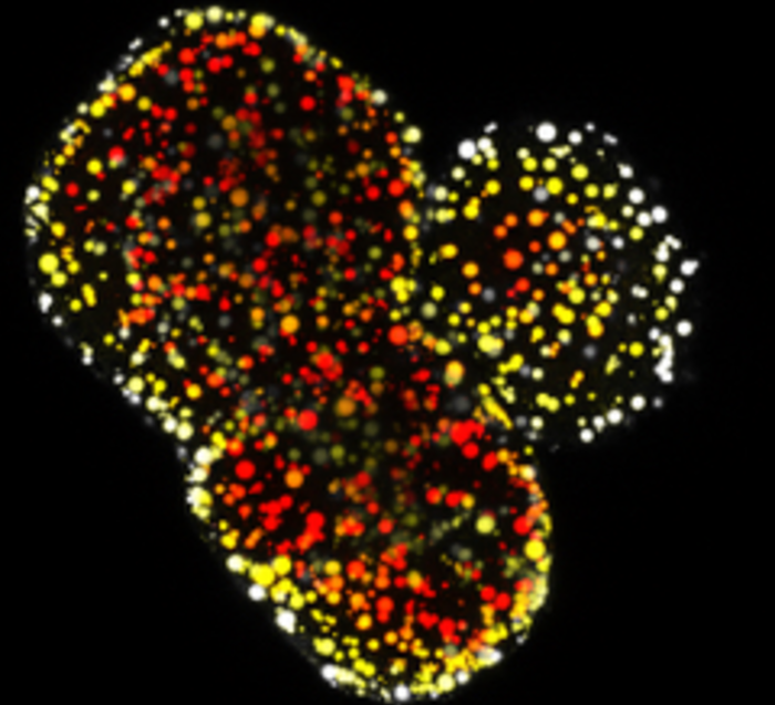 Novel Human Organoid Models of Fatty Liver Disease Developed genengnews.com/liver-diseases… via <a href="/GENbio/">Genetic Engineering & Biotechnology News</a>