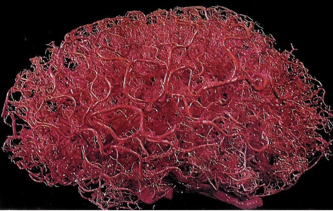 hilana_hatoum's tweet photo. @AvrahamCooperMD And This is our vascular brain network - length ~ 400 miles !!!!! https://t.co/gt7P7u8D7s