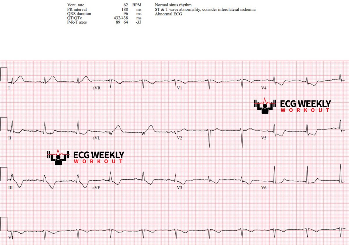 ECGWeekly tweet media