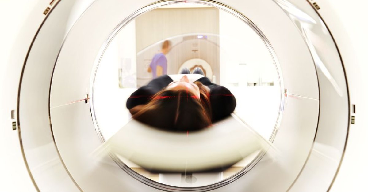 Het blijkt niet mogelijk om op basis van een MRI-scan de diagnose depressie te stellen. Onderzoekers van Amsterdam UMC keken met behulp van kunstmatige intelligentie naar scans van mensen met en zonder depressie. buff.ly/3Slo1Bm