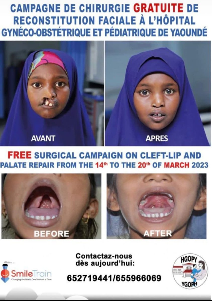 AnneNjom's tweet photo. Faire circuler afin que ceux atteints de ces diverses malformations puissent y bénéficier https://t.co/g8c72JTXXB