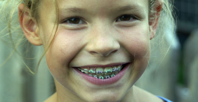 Raganortho's tweet photo. When is a good time for your child to get #Braces? Call us to find out! #Dallas https://t.co/jadqno7Zv9 https://t.co/eq71uGNPWM