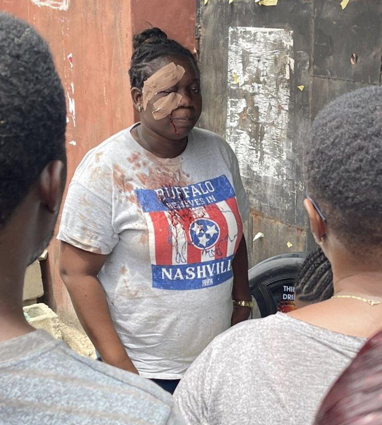 Taofiq's tweet photo. The woman that APC thugs wounded with bottle came back to vote. This is the Hero of this election. ❤️🇳🇬

#NigeriaElections2023 #ObiWon #SOSREX #PeterObiForPresident2023 Labour party casted https://t.co/4UcHaGxhZG