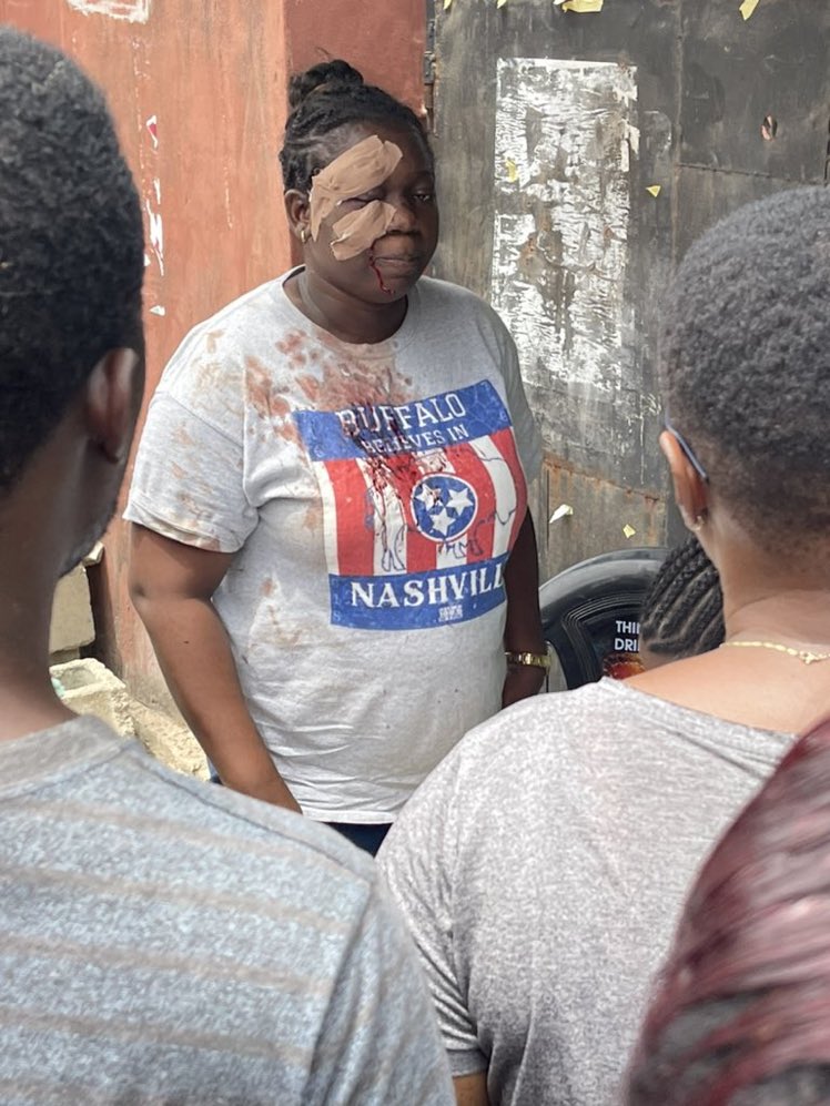 stanleycrisss's tweet image. This is the lady the Apc thugs beat and stabbed with bottle and after treatment and regaining consciousness she came back to vote. People are determined to Liberate this country