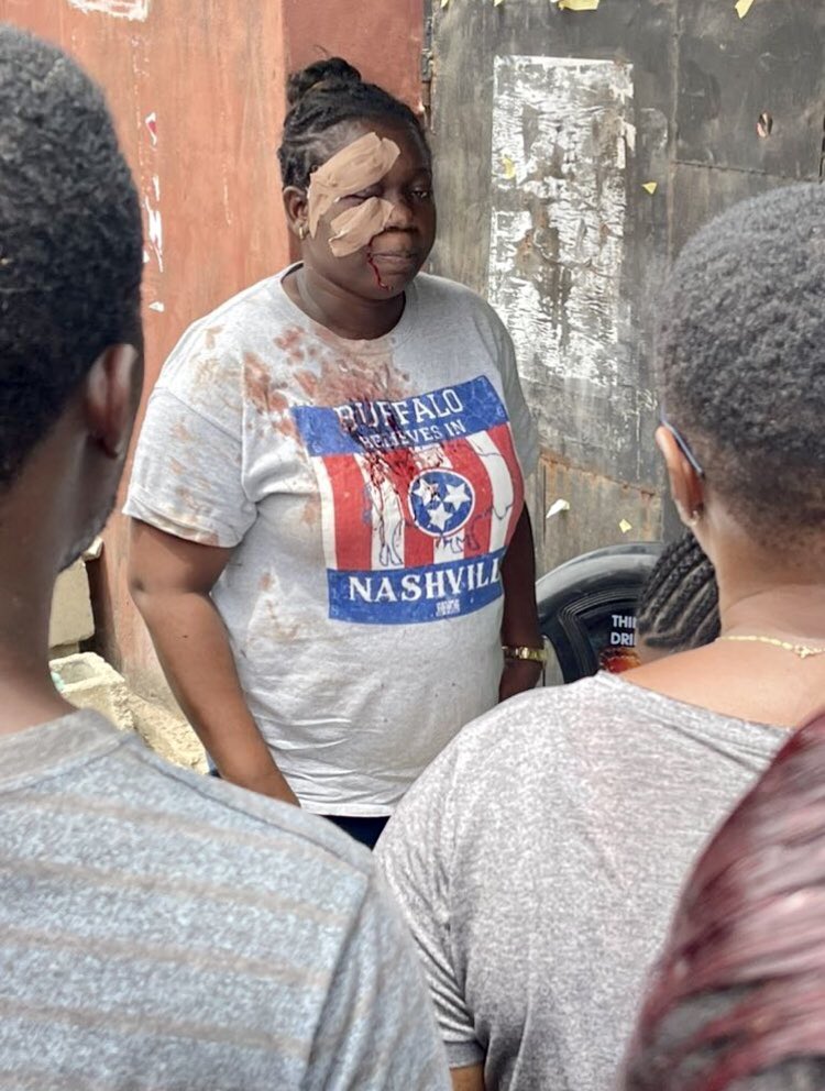 firstladyship's tweet photo. She was wounded by APC thugs, but she came back to vote. She is the hero of the day. Who can locate her for me? 😫✊👏 https://t.co/rsxPEZf92J