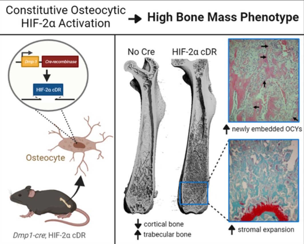 Results from a new #JBMRPlus study reveal a novel influence of osteocytic HIF-2α in driving HBM phenotypes that can potentially be harnessed pharmacologically to improve bone mass &amp; reduce fracture risk #openaccess #freetoread @ChristiansenLab <a href="/LootsLab/">Loots Lab</a> 

ow.ly/6KtH50MXcah