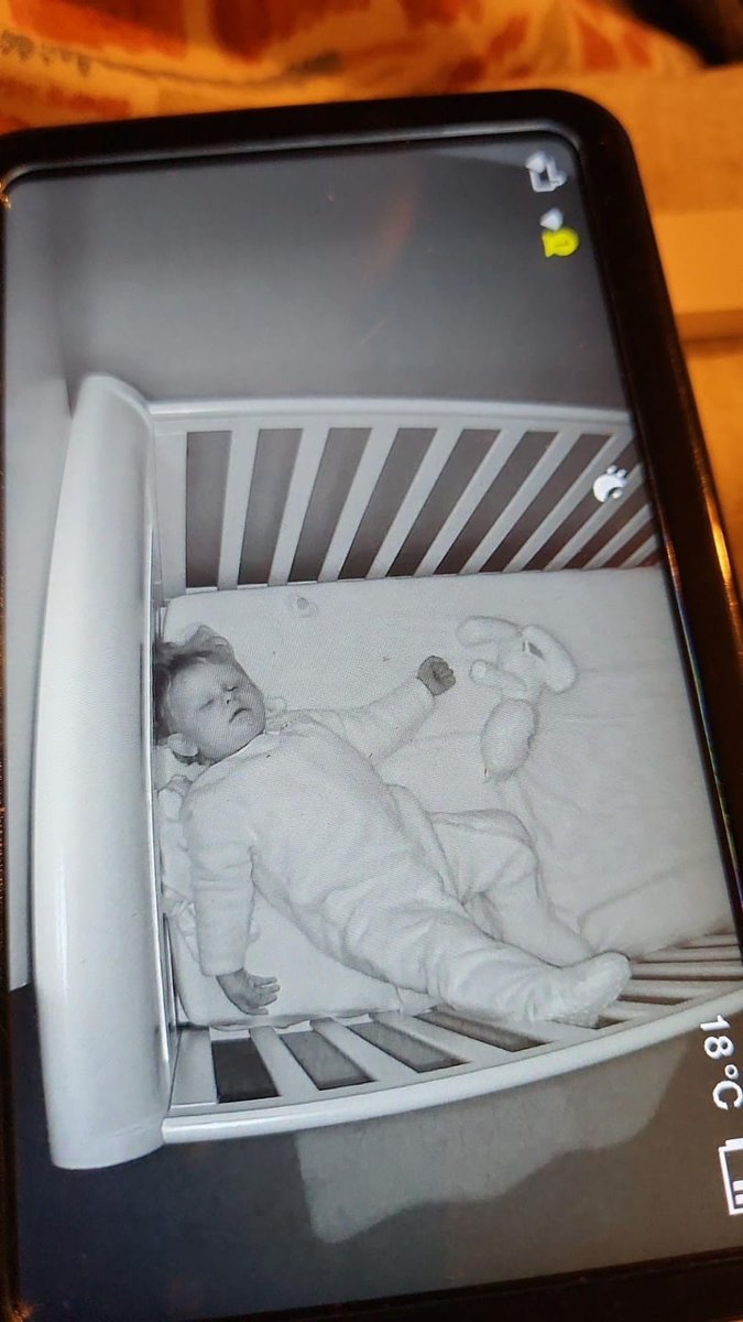 ProperOnions's tweet image. My 15 month old daughter looking more like @LewisCapaldi than Lewis Capaldi