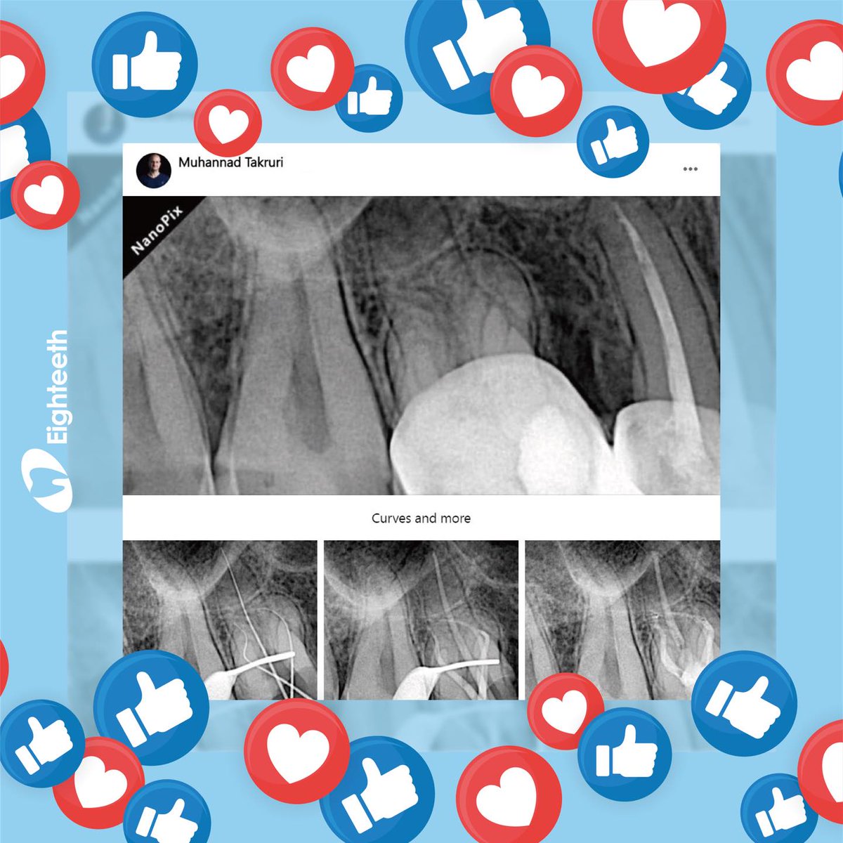 "𝘾𝙪𝙧𝙫𝙚𝙨 𝙖𝙣𝙙 𝙢𝙤𝙧𝙚"
😃Take the digital life, experience the perfection with Eighteeth 𝙉𝙖𝙣𝙤𝙋𝙞𝙭.
#NanoPix
#Eighteeth