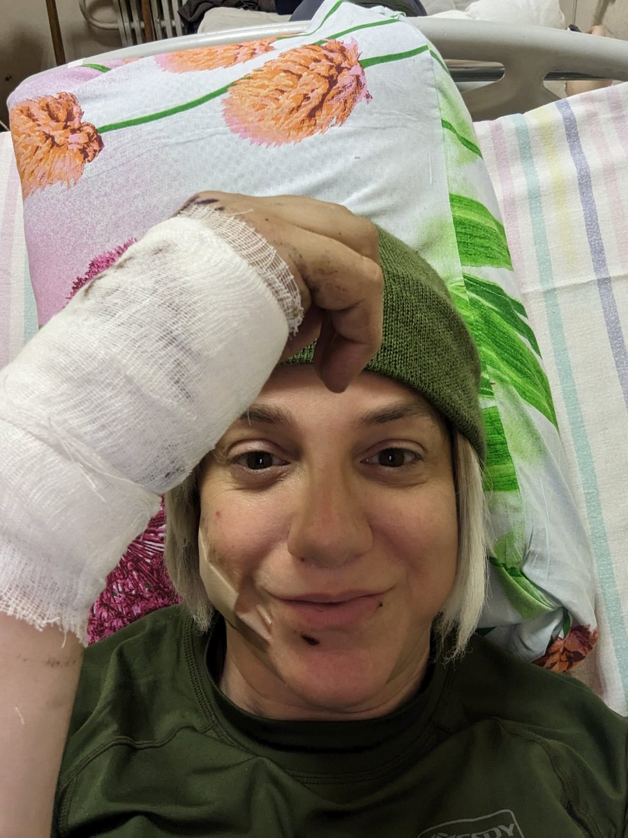 AshtonCirillo's tweet image. They have just worked on my hand at the newest hospital.

Tissue damage is severe and some nerve issues. 

No schedule on closing the wound. 

Current Prognosis: Blessed and Lucky. 

Future Prognosis: Back to the Battlefield.