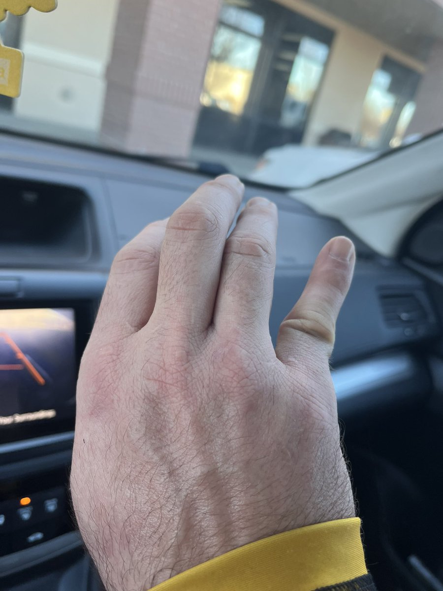 12inchapps's tweet image. No good deed goes unpunished. Fortunately only dislocated . #openmat #JiuJitsu