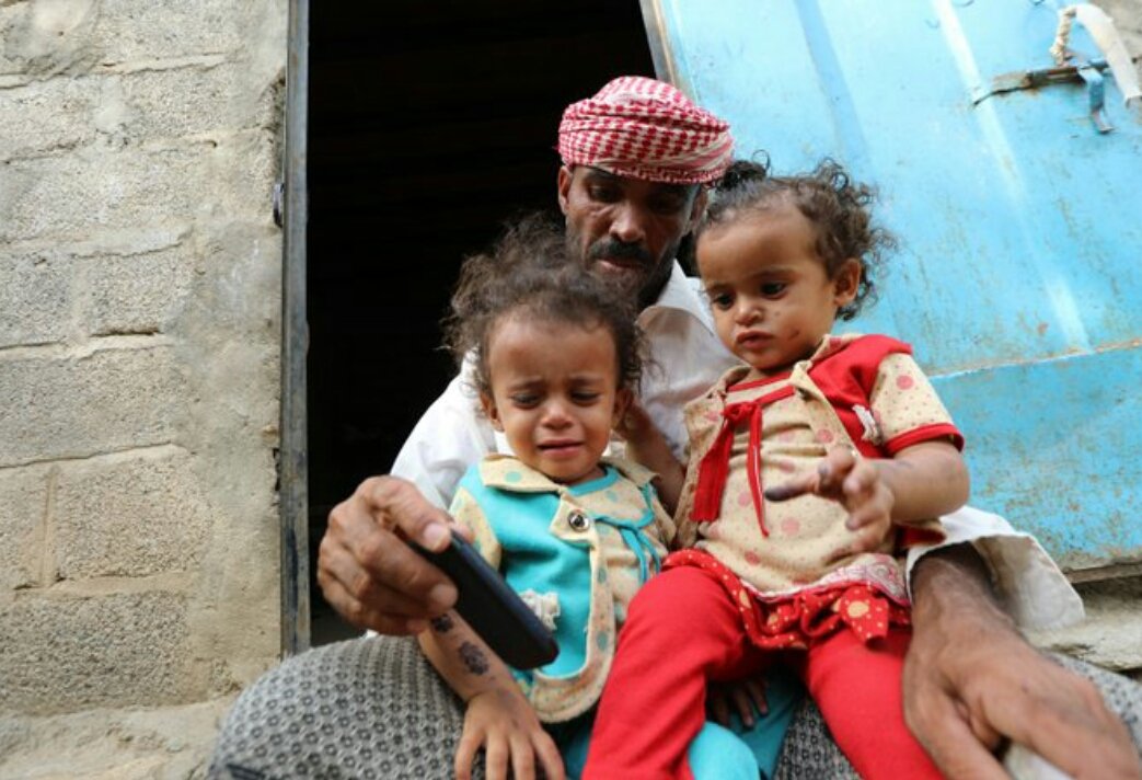 "Many times, my children ask me for food as they are hungry but I cannot afford it. I tell them that I'll bring some food tomorrow. Then they go to sleep hungry." Hatim said
Millions of children in #Yemen are going to bed hungry everyday
Contribute Today: 
gogetfunding.com/emergency-appe…