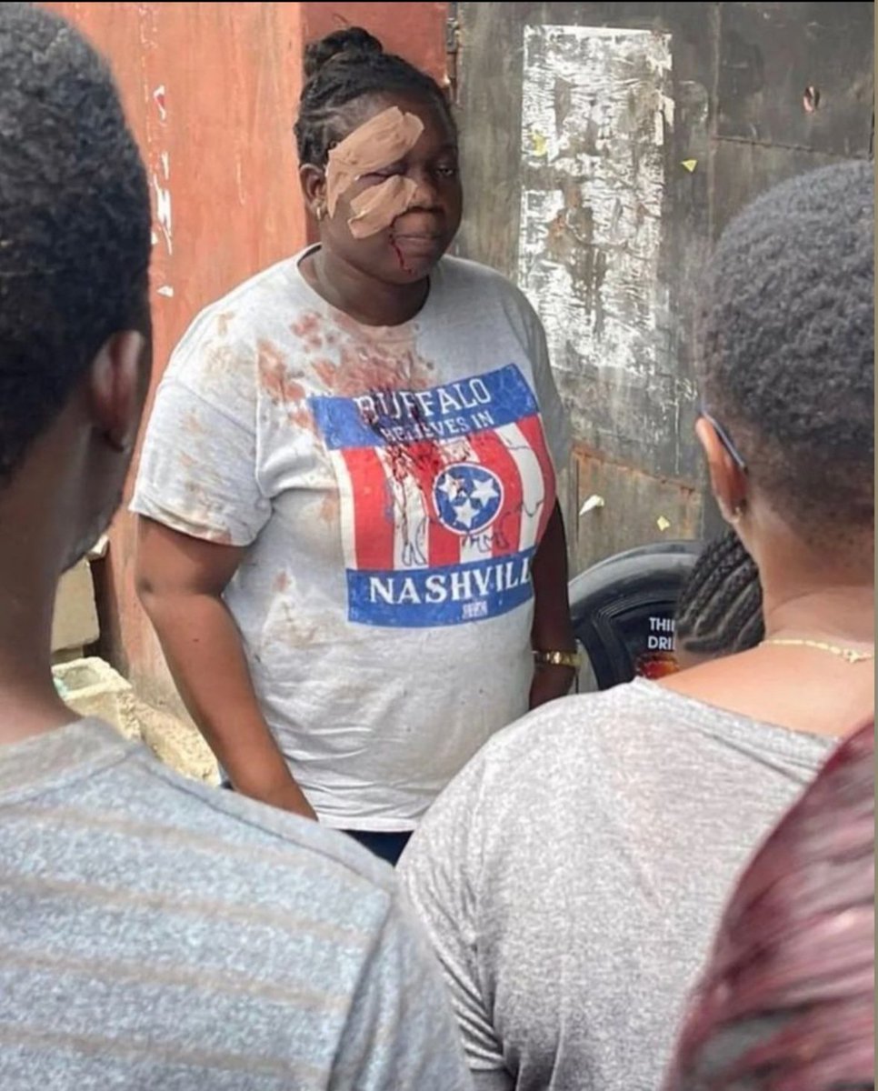 The structure of violence is all they have!! This lady was attacked, she went and got first aid and still came back to vote..!! That is how you shame the oppressor.. I need to find her... Help me Twitter people..