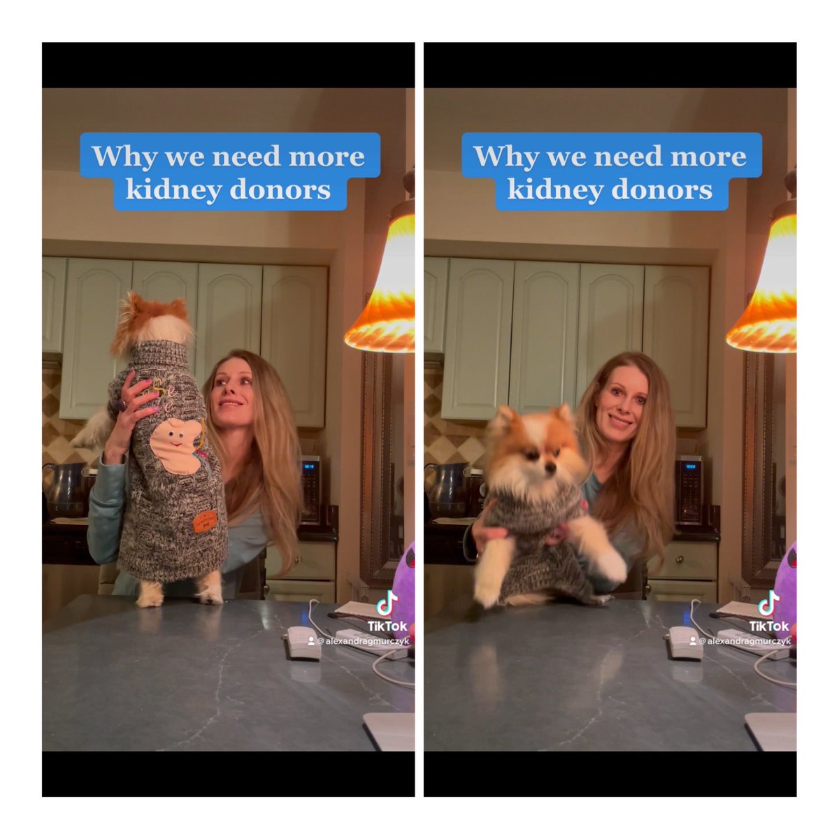 Mimi is wearing her “please donate” sweater to pass on the message that we need more donors! There are 138000 people waiting on the list. Everyday, 100 more are added. Please consider donation 🥰