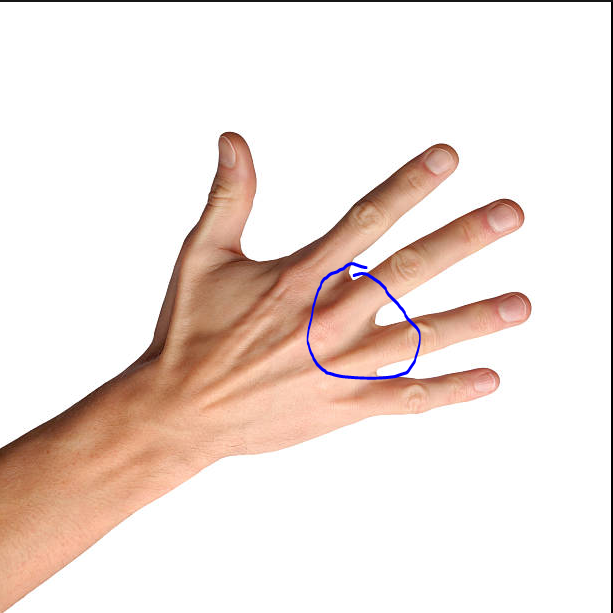 Larson on Twitter "does anyone know why this part of my hand hurts or