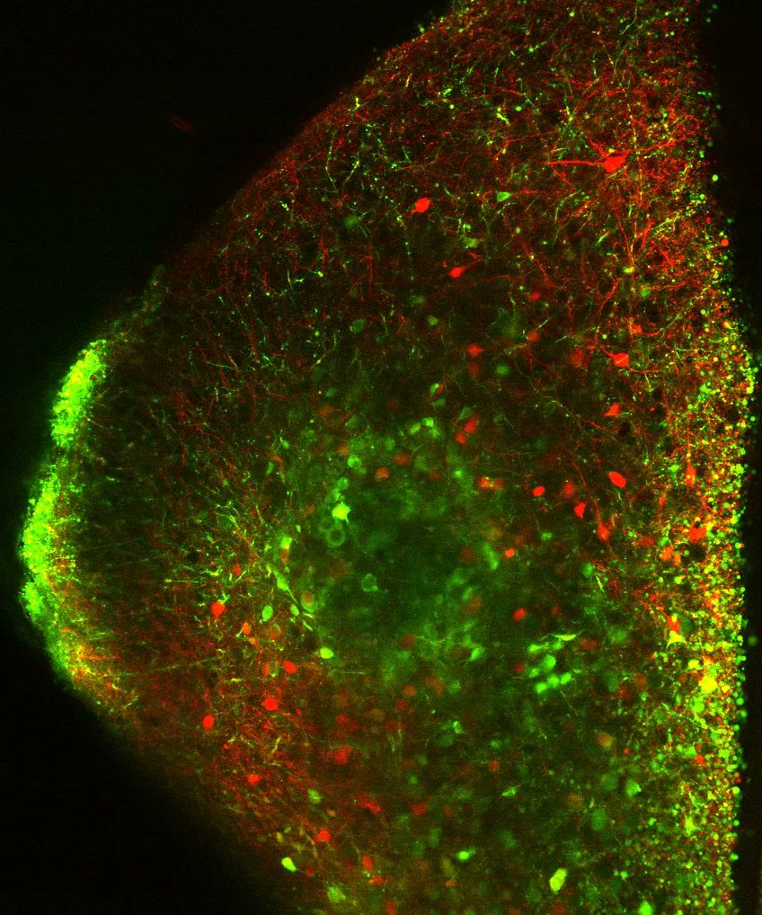 umassOPD's tweet photo. "Aromatase neurons in the brain convert testosterone into estradiol. In the amygdala, they work to coordinate social behavior in mice. We can watch the activity of these neurons using fluorescence and 2-photon microscopy. ”
@natalie_bourdon
#ImagesofResearch #UMassGradImages https://t.co/C0GAxP8yTF