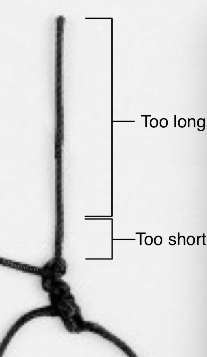OGdukeneurosurg's tweet photo. Important advice to med students on cutting sutures in the operating room. 🧵 https://t.co/rN9ONlCGLc