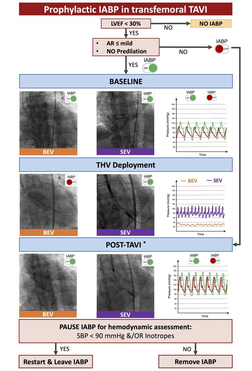 Andrea Scotti (@andreascotti21) on Twitter photo β¨Glad to share at #CRT2023 our <a href="/MonteHeart/">Montefiore Heart</a> experience on Prophylactic IABP in TF-TAVI
πOut now <a href="/EuroInterventio/">EuroIntervention</a>: eurointervention.pcronline.com/article/prophyβ¦
<a href="/azeemlatib/">Azeem Latib</a> <a href="/jgranadacrf/">Juan F. Granada</a> <a href="/m_assafin/">Manaf Assafin</a> <a href="/leoneppmd/">Pier Pasquale Leone</a> @MatteoMSturla <a href="/CurioJonathan/">Jonathan Curio</a> @SebLudwig1 <a href="/SpringMD/">Alexander M. Spring, MD</a>
<a href="/MontefioreNYC/">Montefiore Health System</a> <a href="/EinsteinMed/">Albert Einstein College of Medicine - Official</a> <a href="/crfheart/">Cardiovascular Research Foundation</a> β¨Glad to share at #CRT2023 our <a href="/MonteHeart/">Montefiore Heart</a> experience on Prophylactic IABP in TF-TAVI
πOut now <a href="/EuroInterventio/">EuroIntervention</a>: eurointervention.pcronline.com/article/prophyβ¦
<a href="/azeemlatib/">Azeem Latib</a> <a href="/jgranadacrf/">Juan F. Granada</a> <a href="/m_assafin/">Manaf Assafin</a> <a href="/leoneppmd/">Pier Pasquale Leone</a> @MatteoMSturla <a href="/CurioJonathan/">Jonathan Curio</a> @SebLudwig1 <a href="/SpringMD/">Alexander M. Spring, MD</a>
<a href="/MontefioreNYC/">Montefiore Health System</a> <a href="/EinsteinMed/">Albert Einstein College of Medicine - Official</a> <a href="/crfheart/">Cardiovascular Research Foundation</a>