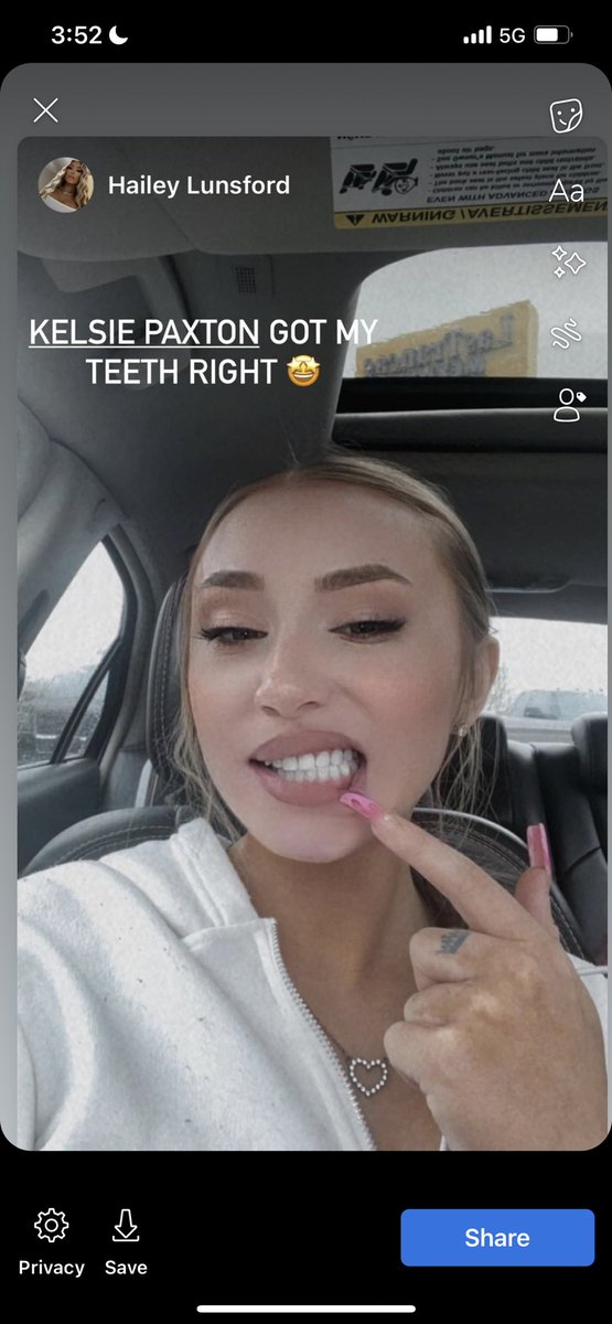 lashgoddesswv's tweet photo. @haileylunsford_ came to see me for teeth whitening 🤍🦷🤍

#charleston #charlestonwv #charlestonwvhair #charlestonwvlashes #wvlashes #wvhair #teethwhitening #teethwhiteningspecialist #whiteteeth #ledteethwhitening #wvdental #beforeandafter #beforeandafterteeth https://t.co/8utTBz2KTb