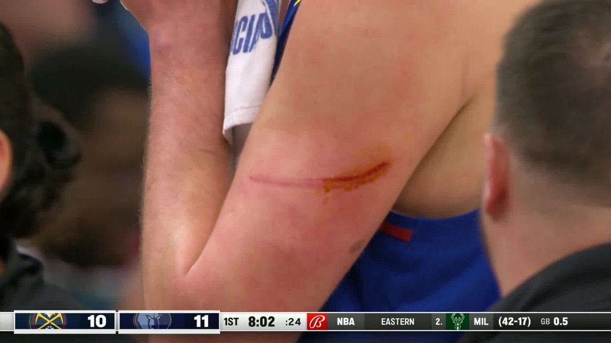 BleacherReport's tweet photo. Jokic's cut... OUCH 😳 https://t.co/jDLU2hsyCx