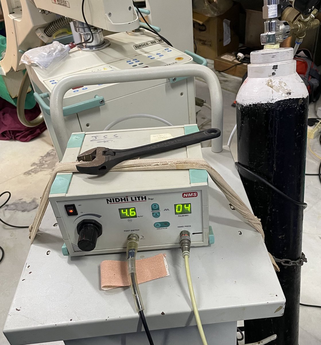 Alex Chow, MD (@alexanderchowmd) on Twitter photo Wrapping up PCNL #10 in India with crossed fused ectopic kidney. Only IVP. No laser. No flex scope. Only glide wire for access/dilation. Single puncture by chief res. Incredible working together <a href="/RushUrology/">Rush Urology</a> <a href="/OneGlobalVill/">One Global Village</a> to deliver excellence with what little is available. Wrapping up PCNL #10 in India with crossed fused ectopic kidney. Only IVP. No laser. No flex scope. Only glide wire for access/dilation. Single puncture by chief res. Incredible working together <a href="/RushUrology/">Rush Urology</a> <a href="/OneGlobalVill/">One Global Village</a> to deliver excellence with what little is available.