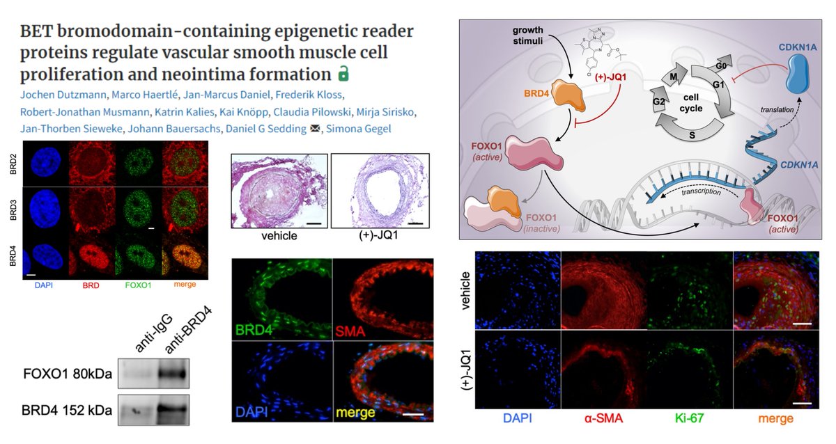 HaoYin20's tweet photo. #Foxo1 mediates the inhibitory effect of JQ1, a #Bromodomain-containing protein (acetyl-lysine reader) inhibitor, on #SmoothMuscleCell proliferation
+Differential roles of BRD2/3/4 in proliferation🤓
Dr. Daniel Sedding lab #CardiovascRes 2021 @SeddingUni
https://t.co/5iusiVDKiq https://t.co/ANh0TXKYvI