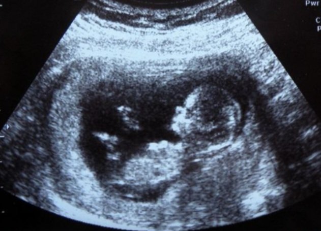 dime_dropa's tweet photo. #vss365 #PoemADay
She had aborted her baby 
A fetus they'd say
Later with sonogram
It became clear 
That fully formed babies appear
The pain and guilt were heavy to carry
She arranged a funeral and
In the tiny casket filled with 
#Potpourri 
She buried 
Laying 
To rest
Her baby https://t.co/FoMqyLLCUE