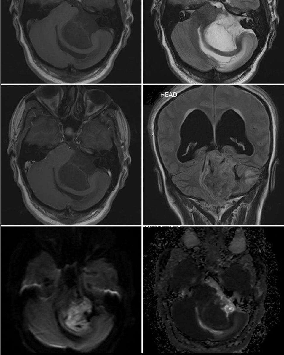 Pakistan Academy of Neurological Surgery tweet media