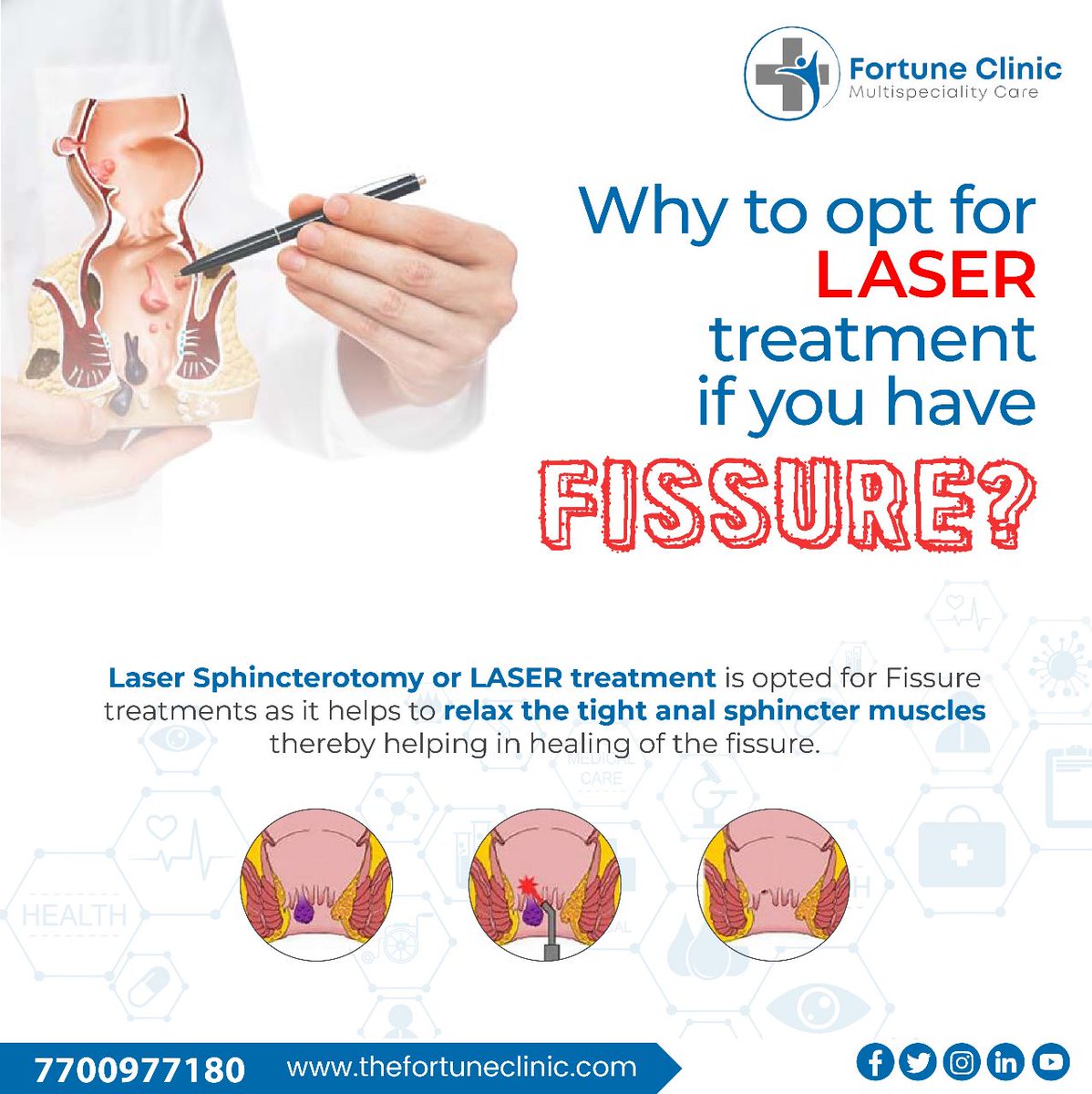 ClinicFortune's tweet photo. Laser Sphincterotomy or LASER treatment is opted when a patient suffers from chronic fissure. Use of laser relaxes the muscles after which the Fissure heals completely. 

#ThinkSurgeryThinkFortune #drsunnyagarwal #fortuneclinic #surgeries #laser #painless #painfree #fissure https://t.co/BD2K2uqqBZ