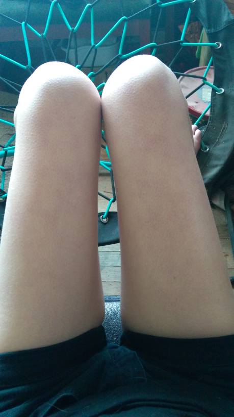 thinimin_'s tweet photo. thinspo edtwt anatwt proanatwt thin$po https://t.co/4j0xL1Qcbg
