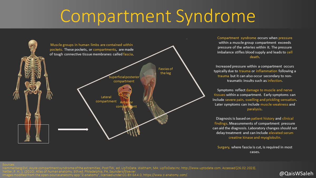I recently listened to a podcast where @felderpaul described his experience with #compartmentsyndrome (CS). I decided to make a small summary. Interesting fact: CS is usually seen in the legs or forearms but can occur in any compartment, including the abdomen.