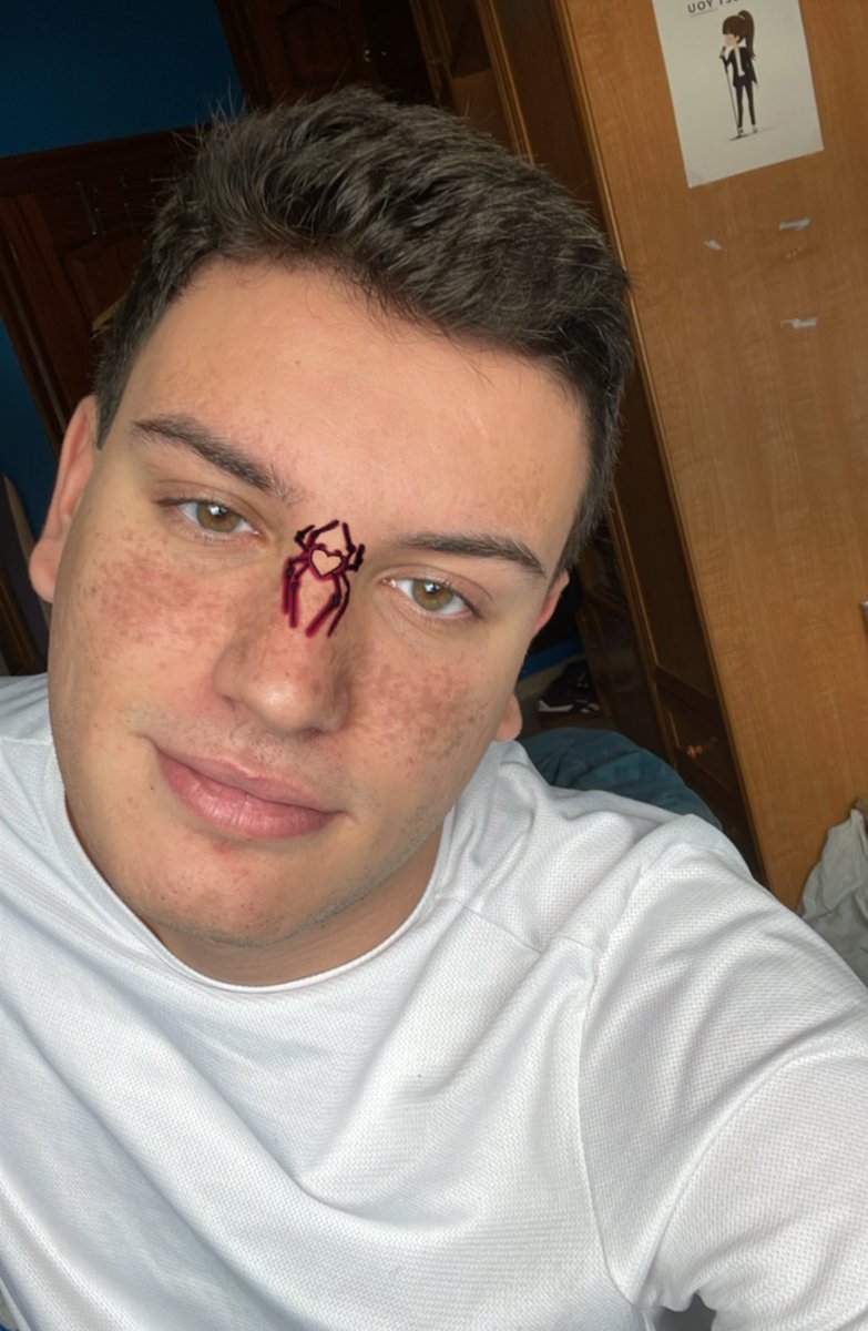 alvarolangarita's tweet image. ayer me corté el pelito jjj