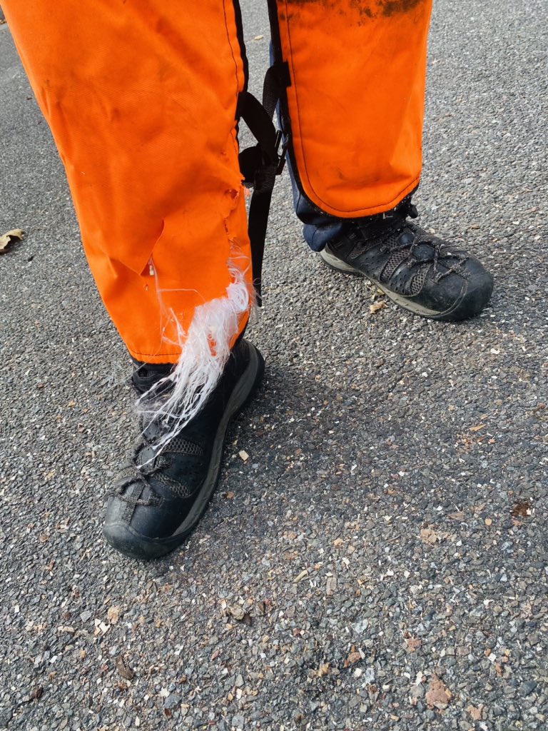 stokesmichael22's tweet photo. @HowThingsWork_ These chaps definitely saved my life if it wasn’t for them I would of lost my ankle #SafetyFirst #PPE https://t.co/Se2ZMDNo5w