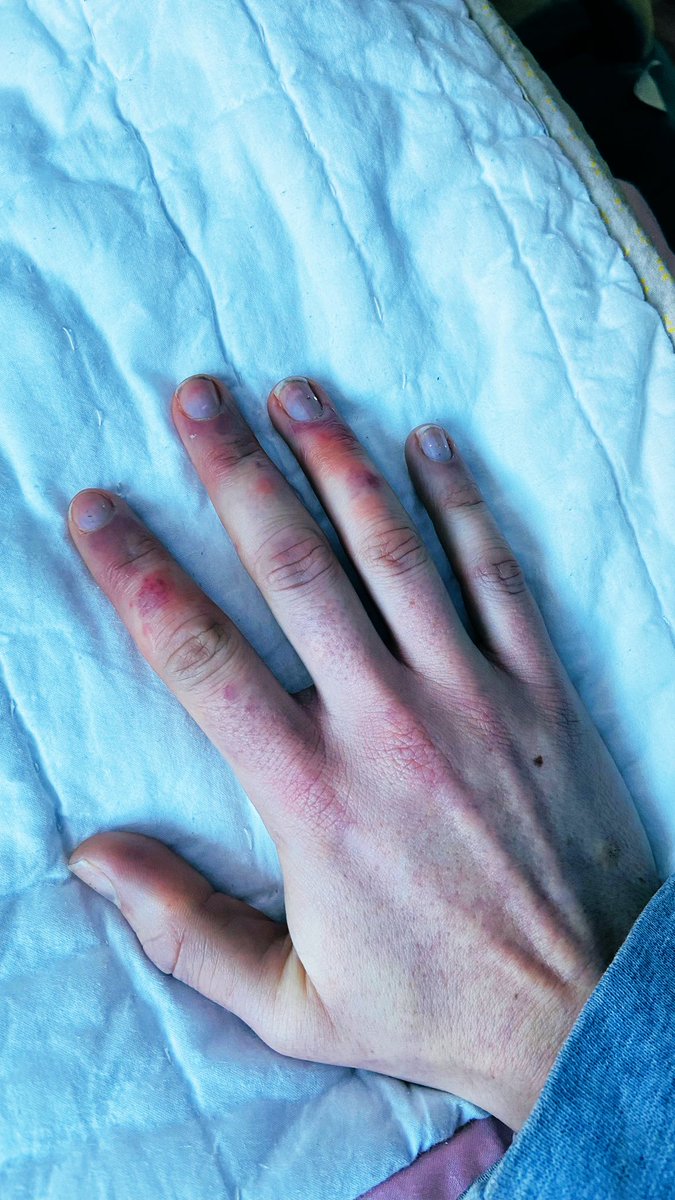 Norma noyce tweet media