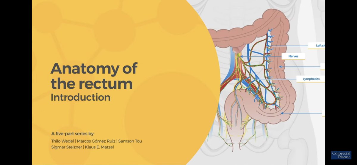ColorectalDis's tweet image. 🎁#CodiSundays 🎁

@escp_tweets &amp;amp; @colorectaldis look at: 

✨🔬Anatomy of the Rectum🔬✨

✅ A 5️⃣-part video developed by @escp_tweets / European School of Coloproctology 

🔗link🔗

youtu.be/QJhh33aC_aw

#SoMe4Surgery #colorectalsurgery