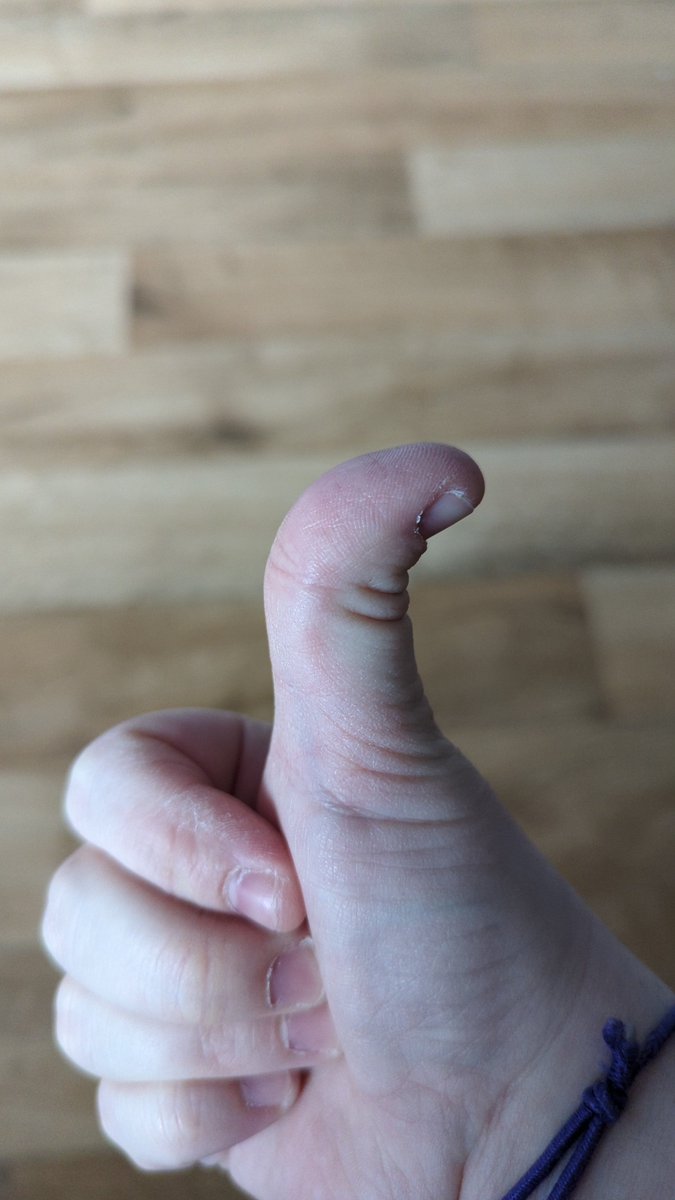 Mysticalsox's tweet photo. @RevRichardColes @Kate_NW11 I have a magic thumb too! https://t.co/2gPKttRzQ3