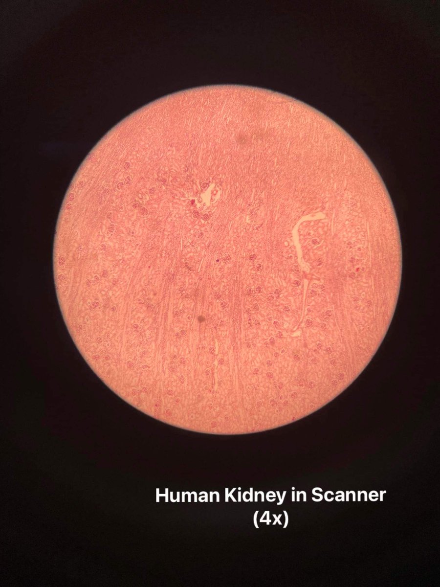 HonieBeeRMT2026's tweet photo. Just observed a human kidney tissue sample under the microscope in our histology lab 🧐🔬 Changing the eyepiece magnification provided an even closer look at this amazing organ💗

#HistologyLab #HumanKidney #Microscopy #studytwt https://t.co/TYndHhPYFm