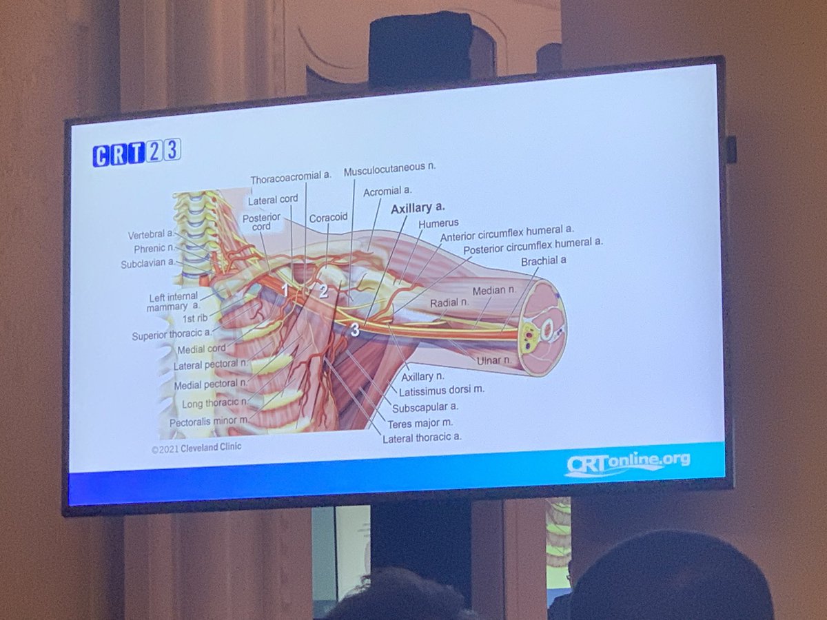 Kristen_BrownMD's tweet photo. Want to know about #Transaxillary access⁉️Happening now @MarvinEng3 presenting in the Empire room #CRT2023 @CRT_meeting https://t.co/d1vDrDJZ4I